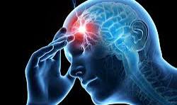 Migraines et céphalées : la piste énergétique
